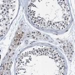 FAM222A Antibody in Immunohistochemistry (Paraffin) (IHC (P))