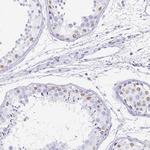 TPSD1 Polyclonal Antibody