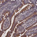 SPATA13 Antibody in Immunohistochemistry (Paraffin) (IHC (P))