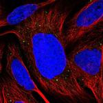 TMEM39B Polyclonal Antibody