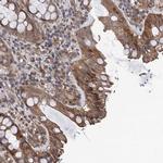TMEM39B Antibody in Immunohistochemistry (Paraffin) (IHC (P))