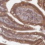 SEC24C Antibody in Immunohistochemistry (Paraffin) (IHC (P))