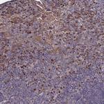 SEC24C Antibody in Immunohistochemistry (Paraffin) (IHC (P))