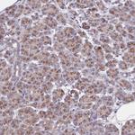 SEC24C Antibody in Immunohistochemistry (Paraffin) (IHC (P))