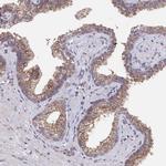 SEC24C Antibody in Immunohistochemistry (Paraffin) (IHC (P))