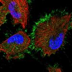 STAMBPL1 Polyclonal Antibody