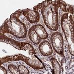STAMBPL1 Antibody in Immunohistochemistry (Paraffin) (IHC (P))