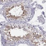 SYCE1 Antibody in Immunohistochemistry (IHC)