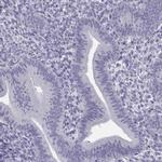 SYCE1 Antibody in Immunohistochemistry (IHC)