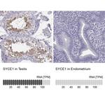 SYCE1 Antibody