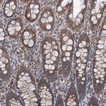 TMEM39B Polyclonal Antibody