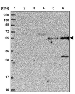 TMEM39B Antibody in Western Blot (WB)