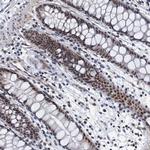 GADL1 Polyclonal Antibody