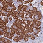 TMEM18 Antibody in Immunohistochemistry (Paraffin) (IHC (P))