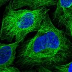 ZDHHC18 Polyclonal Antibody