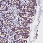 STK32A Polyclonal Antibody