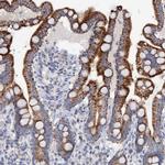 MRPL48 Antibody in Immunohistochemistry (IHC)
