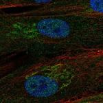 RCBTB2 Polyclonal Antibody