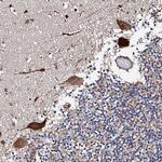 RCBTB2 Antibody in Immunohistochemistry (Paraffin) (IHC (P))