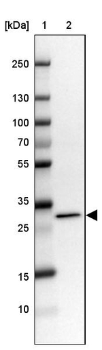 RCBTB2 Antibody in Western Blot (WB)