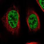 RBM26 Polyclonal Antibody