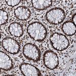 RBM26 Antibody in Immunohistochemistry (Paraffin) (IHC (P))