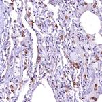 OVCH1 Polyclonal Antibody