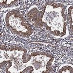 ATP8B4 Antibody in Immunohistochemistry (Paraffin) (IHC (P))