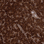 ATP8B4 Antibody in Immunohistochemistry (Paraffin) (IHC (P))