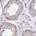 VWA9 Antibody in Immunohistochemistry (Paraffin) (IHC (P))