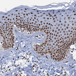 SLTM Antibody in Immunohistochemistry (Paraffin) (IHC (P))