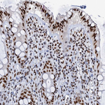 SLTM Antibody in Immunohistochemistry (Paraffin) (IHC (P))