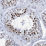 SLTM Antibody in Immunohistochemistry (Paraffin) (IHC (P))