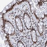 SLTM Antibody in Immunohistochemistry (IHC)
