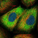 Sorbitol Dehydrogenase Polyclonal Antibody