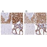 Sorbitol Dehydrogenase Antibody in Immunohistochemistry (IHC)