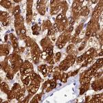 Sorbitol Dehydrogenase Antibody in Immunohistochemistry (IHC)