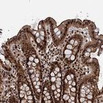 ANR49 Antibody in Immunohistochemistry (Paraffin) (IHC (P))