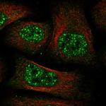 C11orf49 Polyclonal Antibody