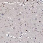C11orf49 Antibody in Immunohistochemistry (Paraffin) (IHC (P))