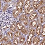 C11orf49 Antibody in Immunohistochemistry (Paraffin) (IHC (P))