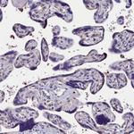 C11orf49 Antibody in Immunohistochemistry (Paraffin) (IHC (P))