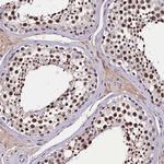 C11orf49 Antibody in Immunohistochemistry (Paraffin) (IHC (P))