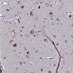 TMX2 Antibody in Immunohistochemistry (Paraffin) (IHC (P))