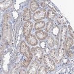 TMX2 Antibody in Immunohistochemistry (Paraffin) (IHC (P))