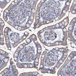 TMX2 Polyclonal Antibody