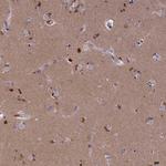 STYX Antibody in Immunohistochemistry (Paraffin) (IHC (P))