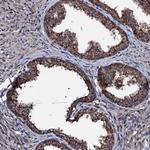 OGFOD2 Antibody in Immunohistochemistry (Paraffin) (IHC (P))