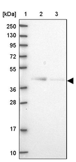 OGFOD2 Antibody in Western Blot (WB)
