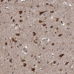 PJA2 Antibody in Immunohistochemistry (Paraffin) (IHC (P))